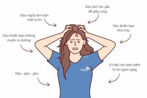 Dầu gội trị gàu