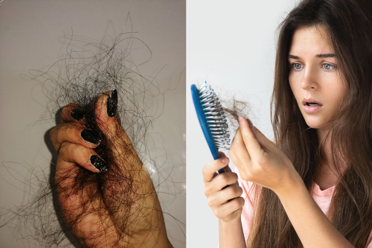 triệu chứng rụng tóc - dầu gội thảo dược cỏ non