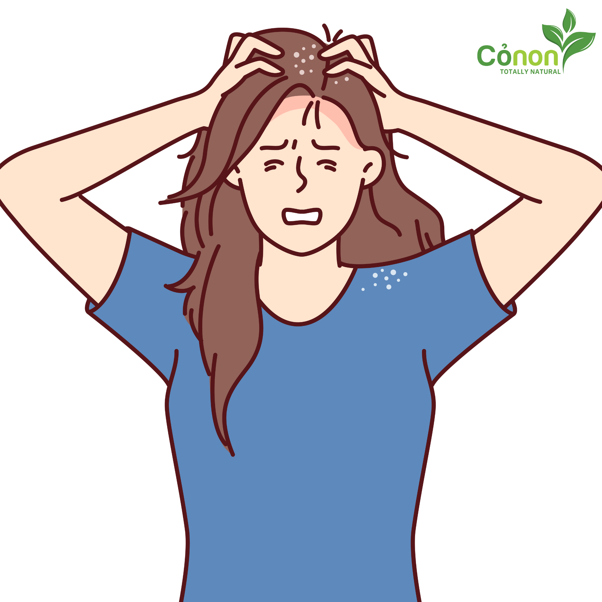 Trị Sạch Gàu Vô Cùng Đơn Giản Cùng Dầu Gội Cỏ Non