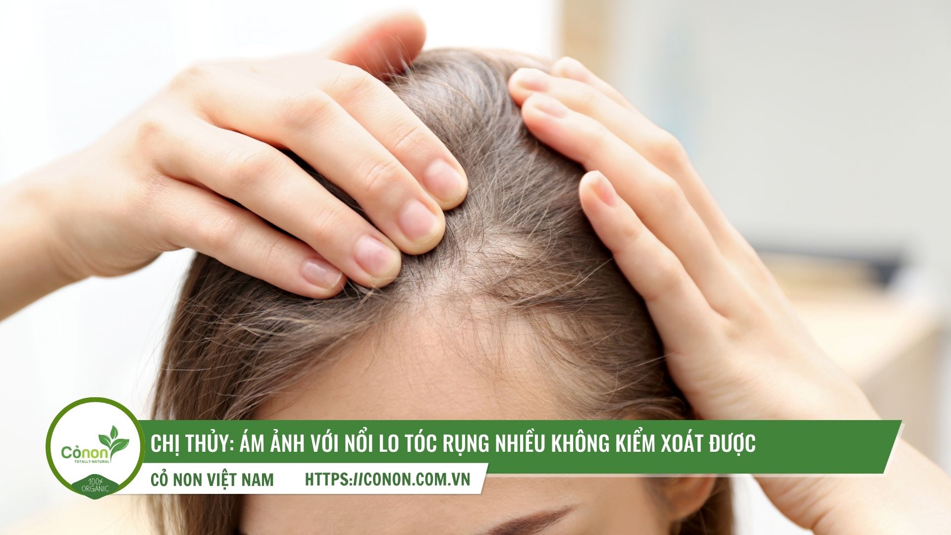 tóc rụng nhiều